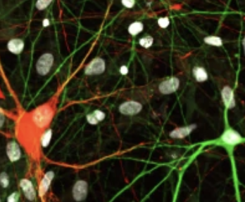 Fluorescence microscopy image of human neurons